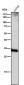 Anti-Cathepsin D CTSD Rabbit Monoclonal Antibody